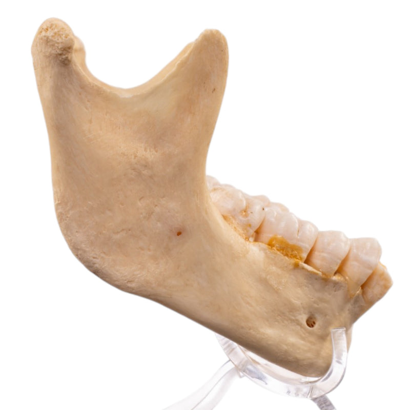 Real Human Mandible