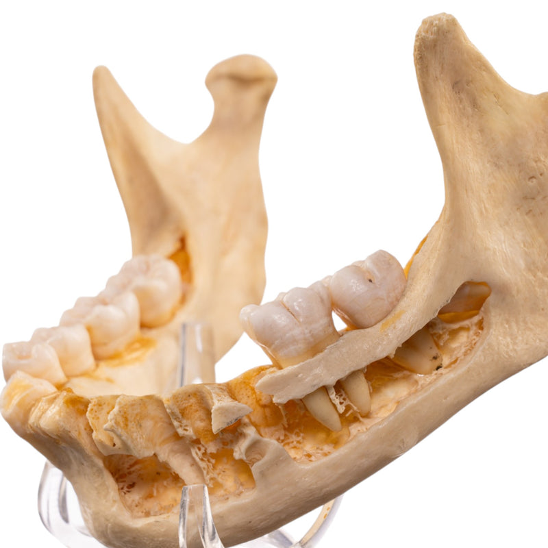 Real Human Mandible
