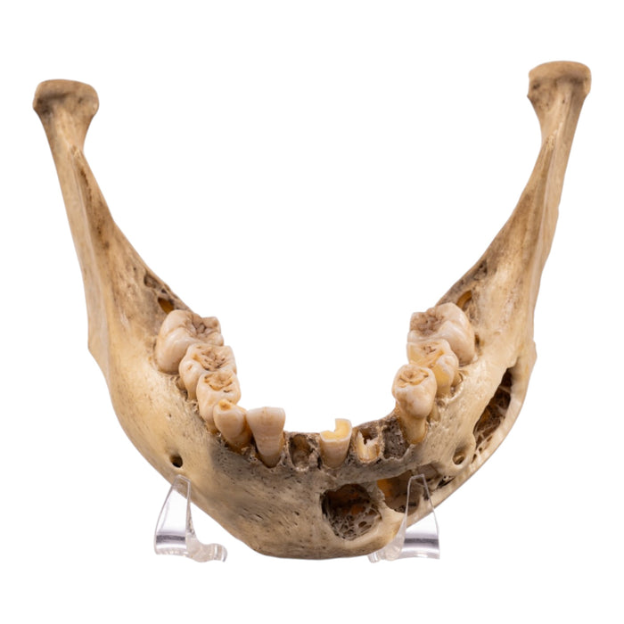 Real Human Mandible - Young
