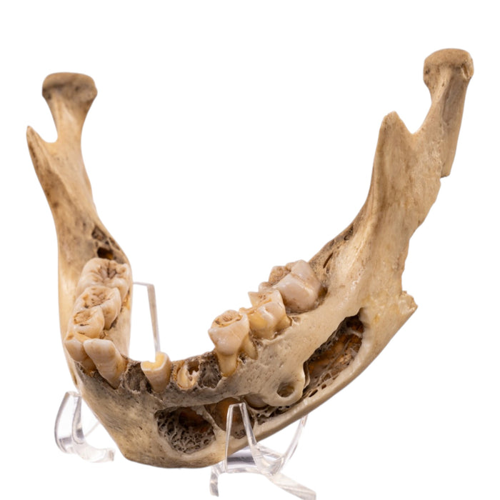 Real Human Mandible - Young