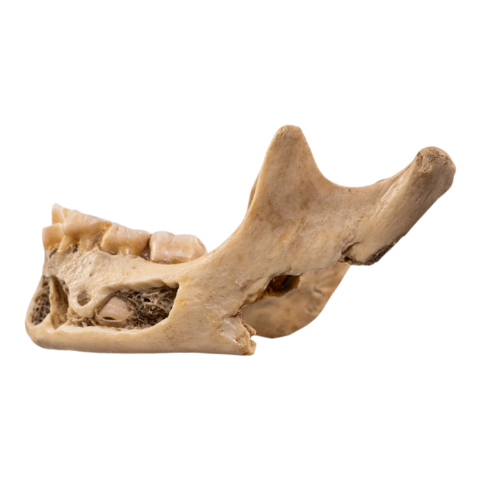 Real Human Mandible - Young
