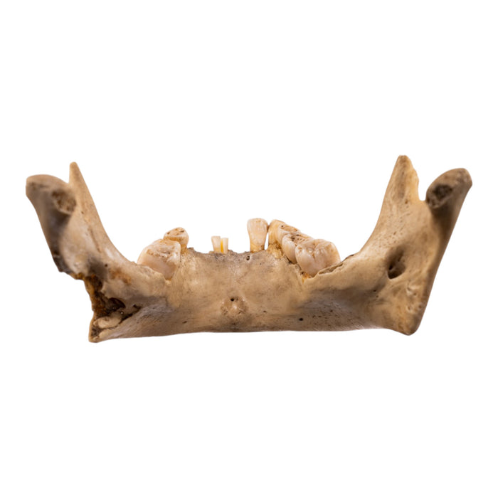 Real Human Mandible - Young