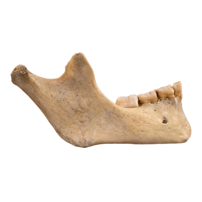 Real Human Mandible - Young
