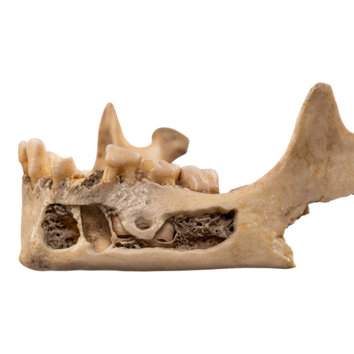 Real Human Mandible - Young