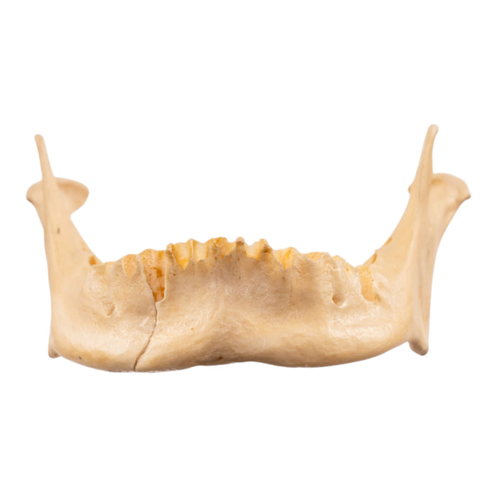 Real Human Mandible - Repaired