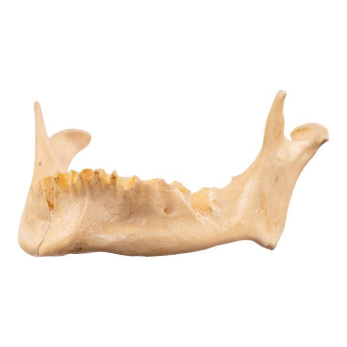 Real Human Mandible - Repaired