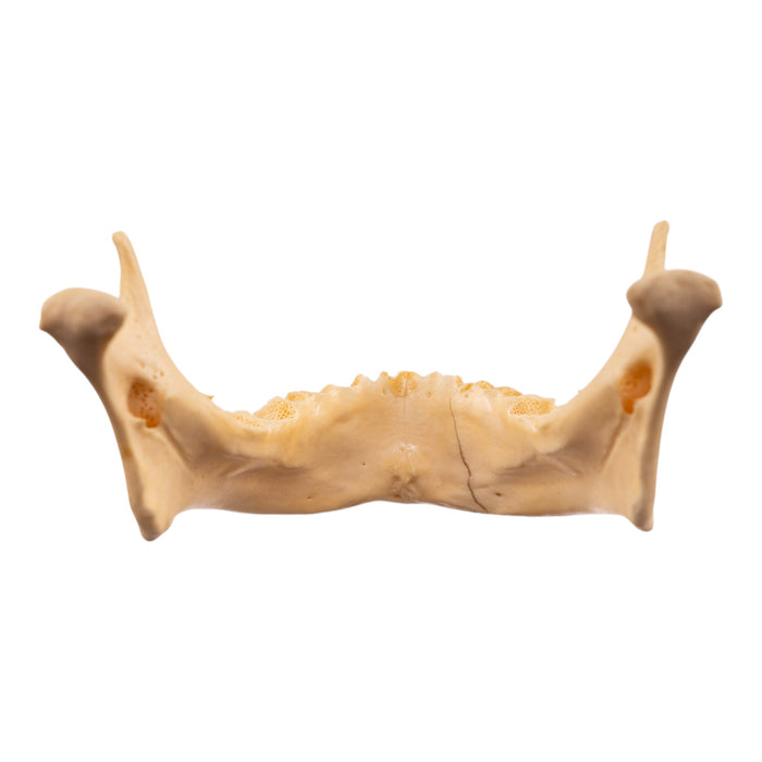 Real Human Mandible - Repaired