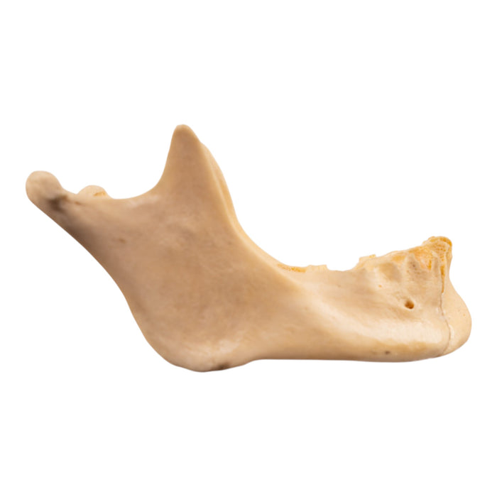 Real Human Mandible - Repaired