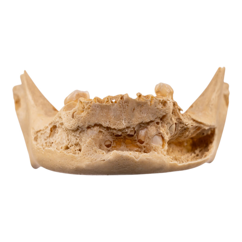 Real Human Mandible