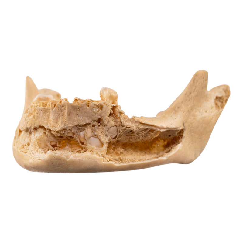 Real Human Mandible