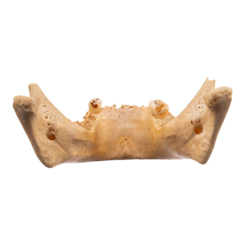 Real Human Mandible