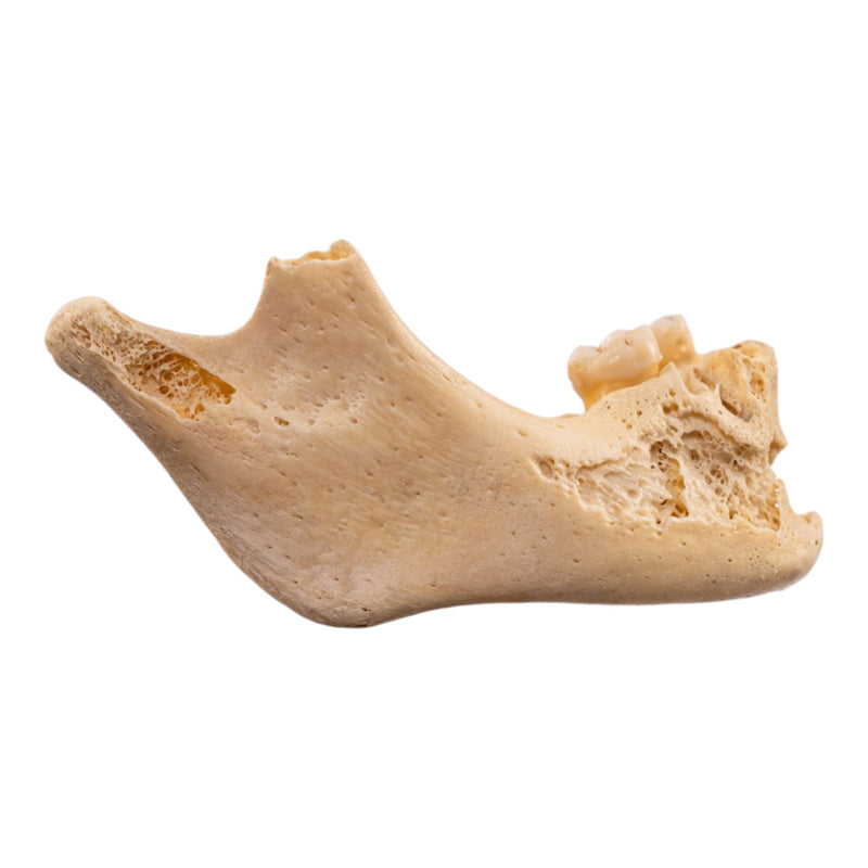 Real Human Mandible