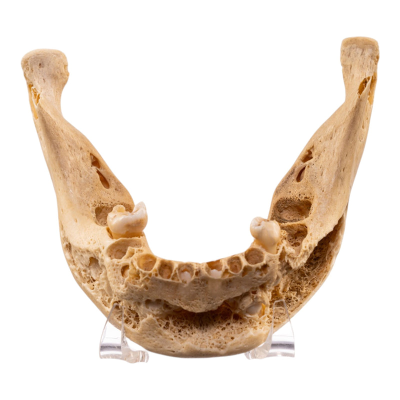 Real Human Mandible