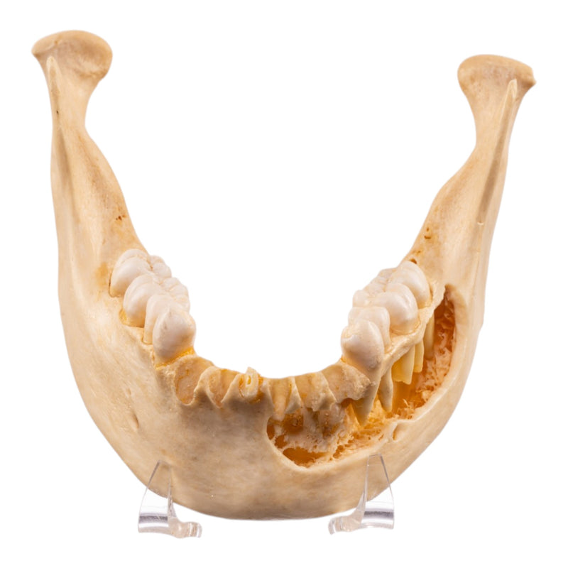 Real Human Mandible - Dissected