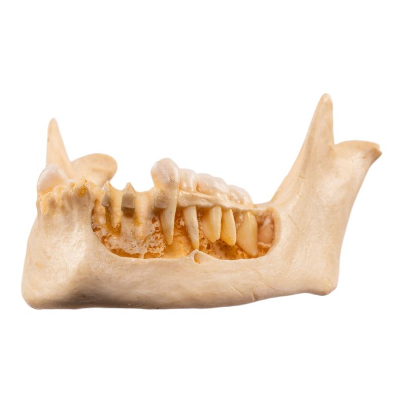 Real Human Mandible - Dissected