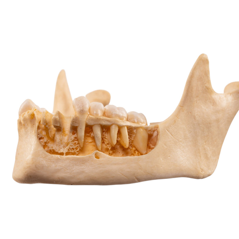 Real Human Mandible - Dissected