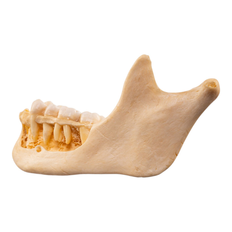 Real Human Mandible - Dissected