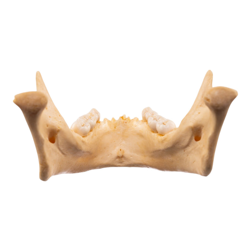 Real Human Mandible - Dissected