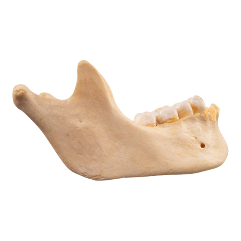 Real Human Mandible - Dissected