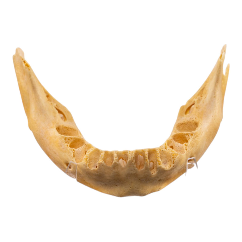 Real Human Mandible - Juvenile