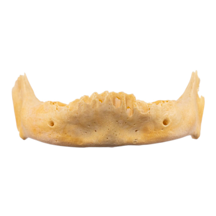 Real Human Mandible - Juvenile