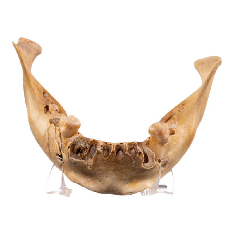 Real Human Mandible