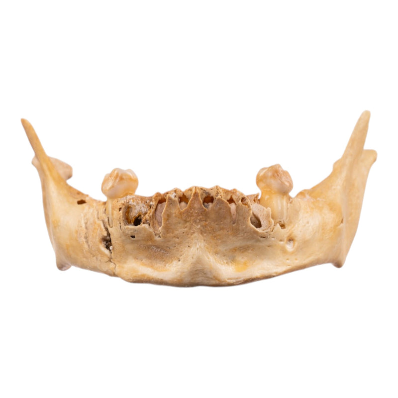 Real Human Mandible