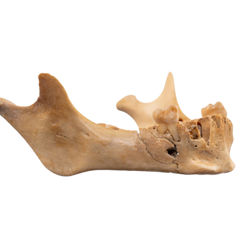 Real Human Mandible
