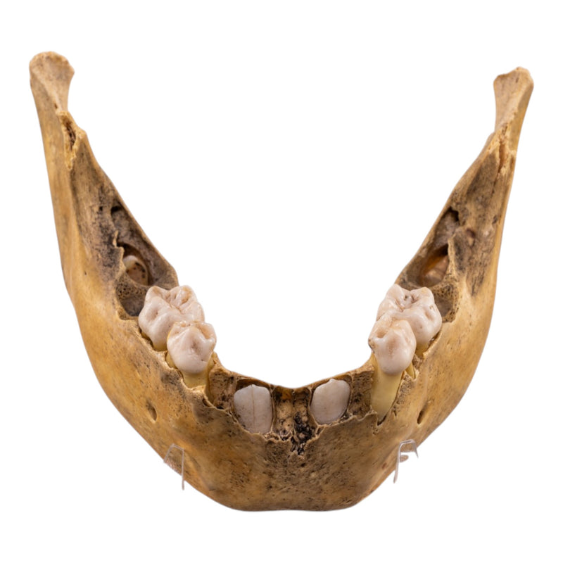Real Human Mandible - Juvenile