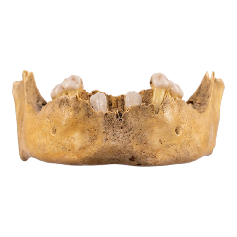 Real Human Mandible - Juvenile