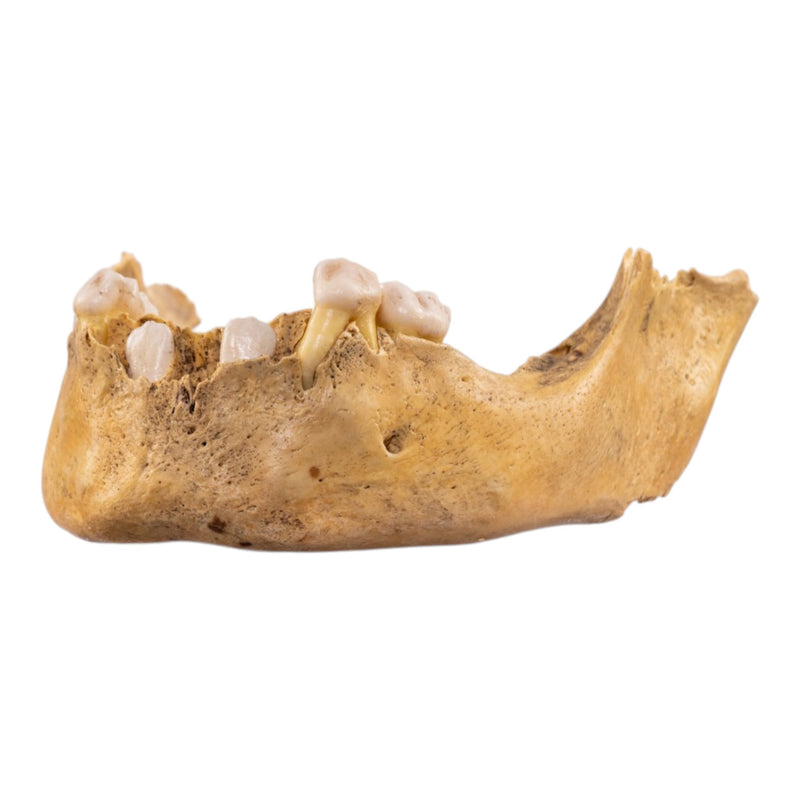 Real Human Mandible - Juvenile