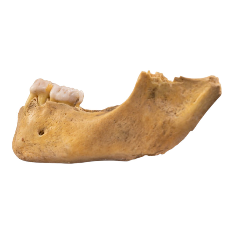 Real Human Mandible - Juvenile