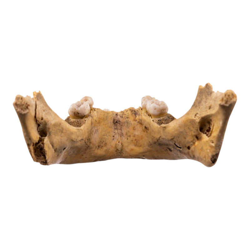 Real Human Mandible - Juvenile