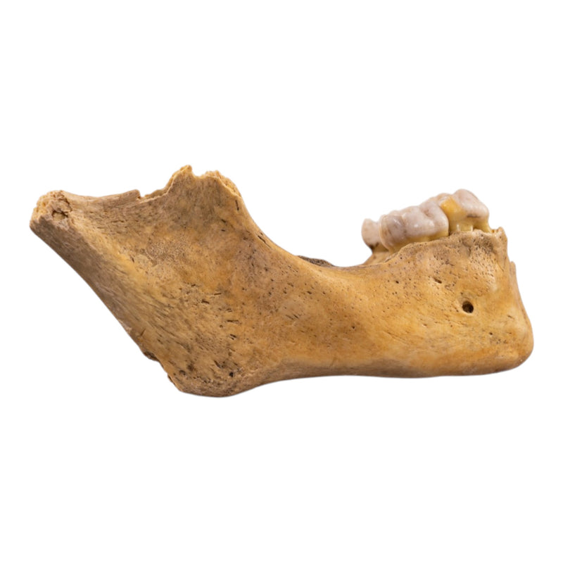 Real Human Mandible - Juvenile