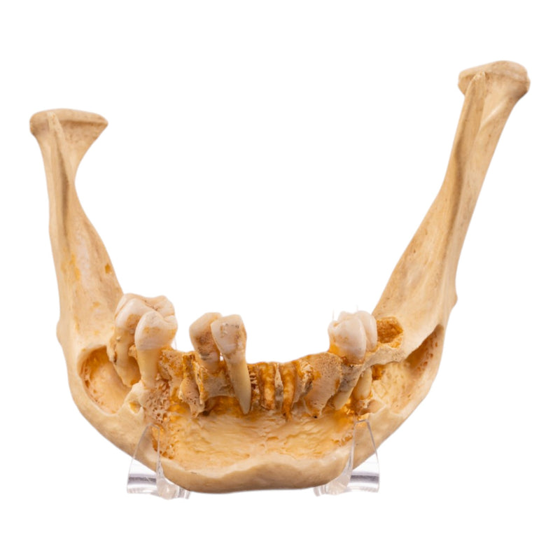 Real Human Mandible - Dissected