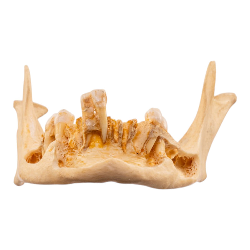 Real Human Mandible - Dissected