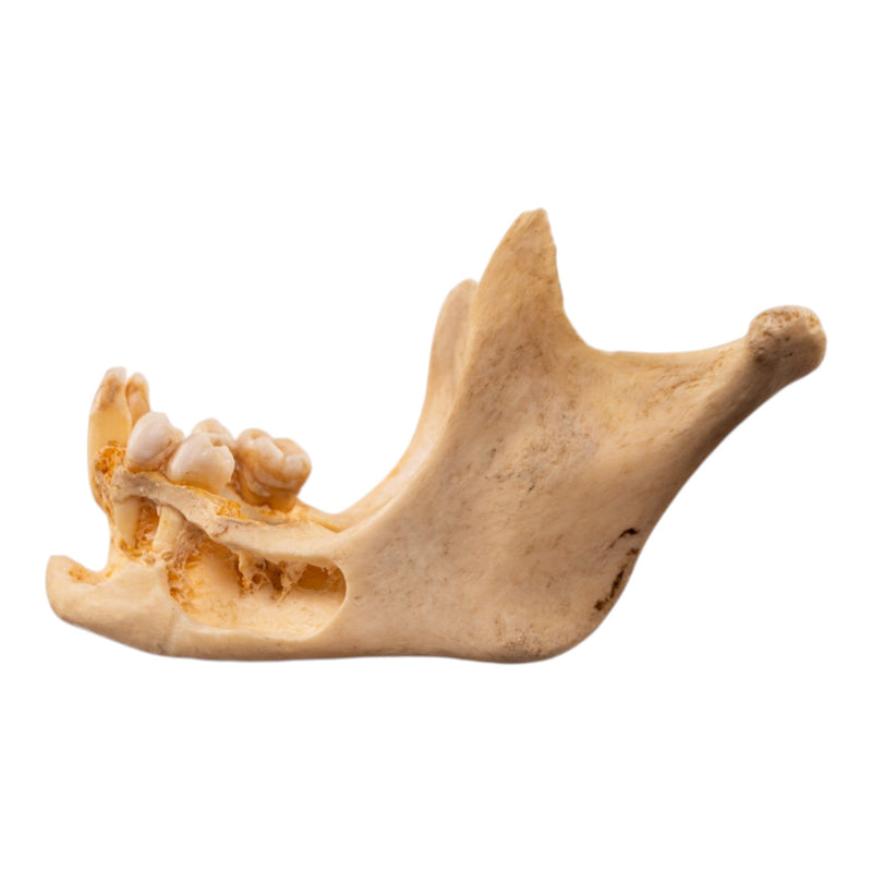 Real Human Mandible - Dissected