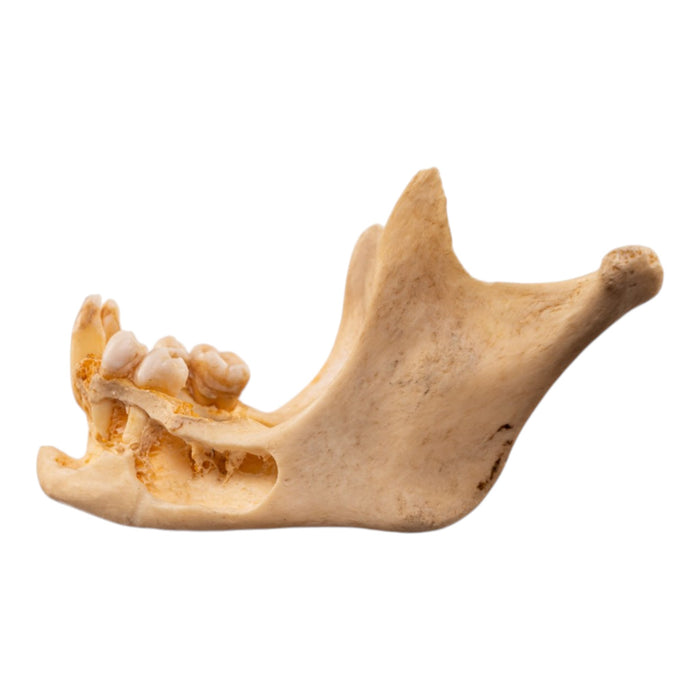 Real Human Mandible - Dissected
