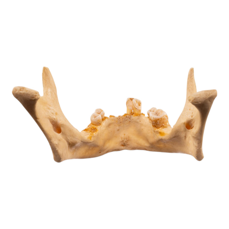 Real Human Mandible - Dissected