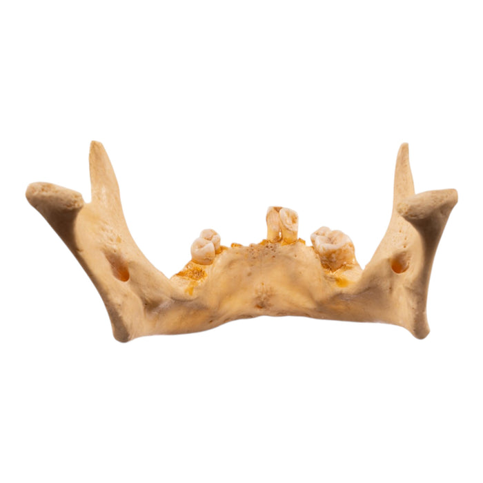 Real Human Mandible - Dissected
