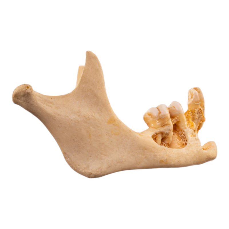 Real Human Mandible - Dissected