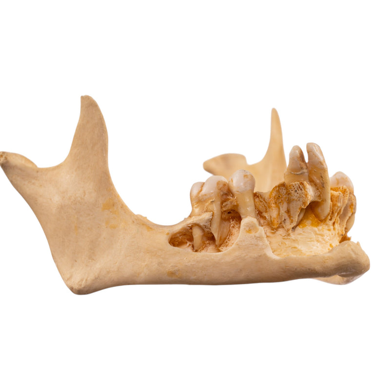 Real Human Mandible - Dissected