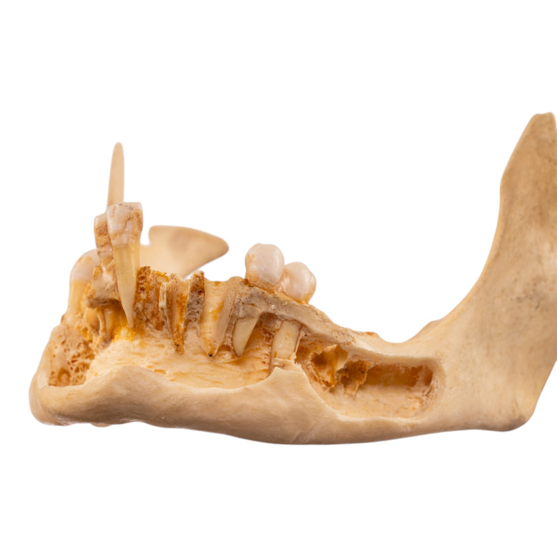 Real Human Mandible - Dissected