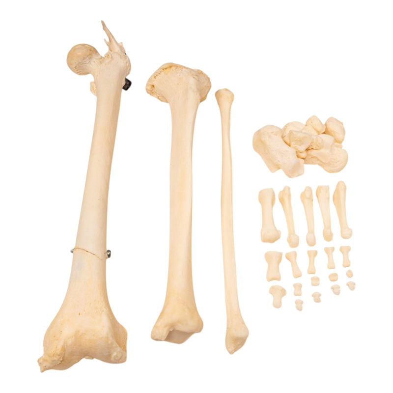Real Human Left Leg - Pathology