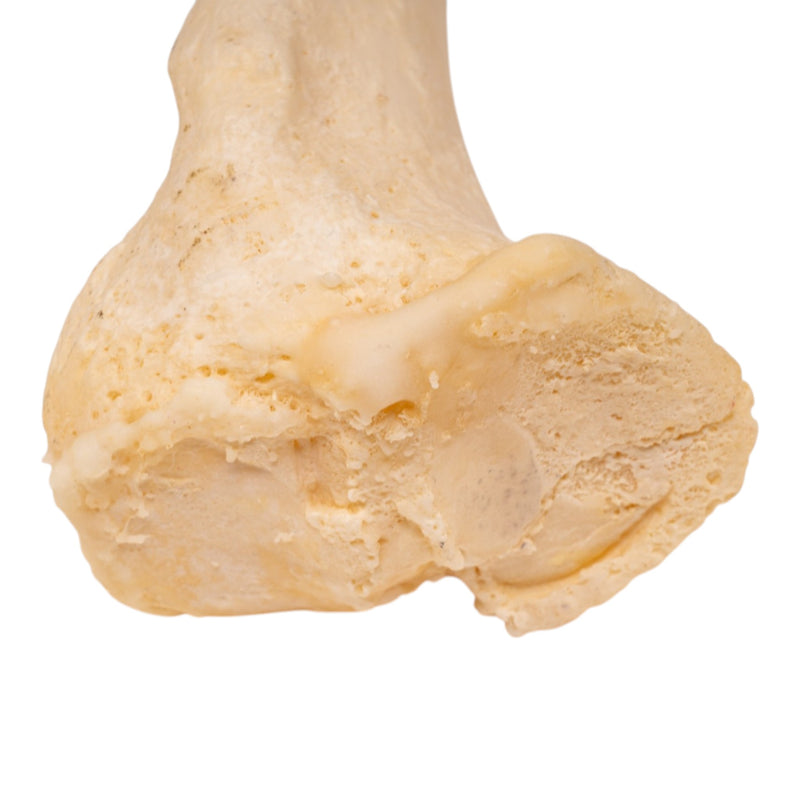 Real Human Left Leg - Pathology