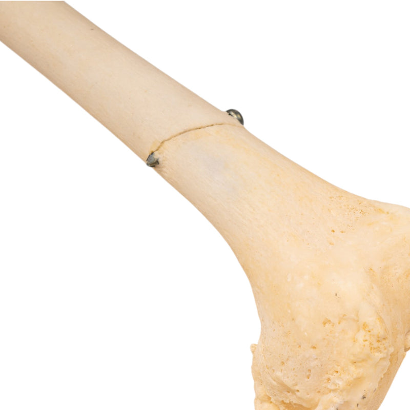 Real Human Left Leg - Pathology
