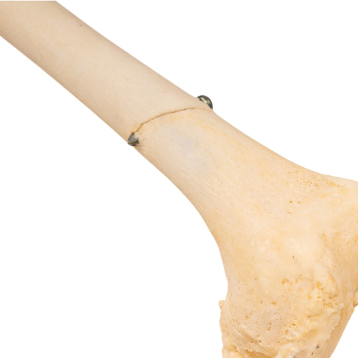 Real Human Left Leg - Pathology