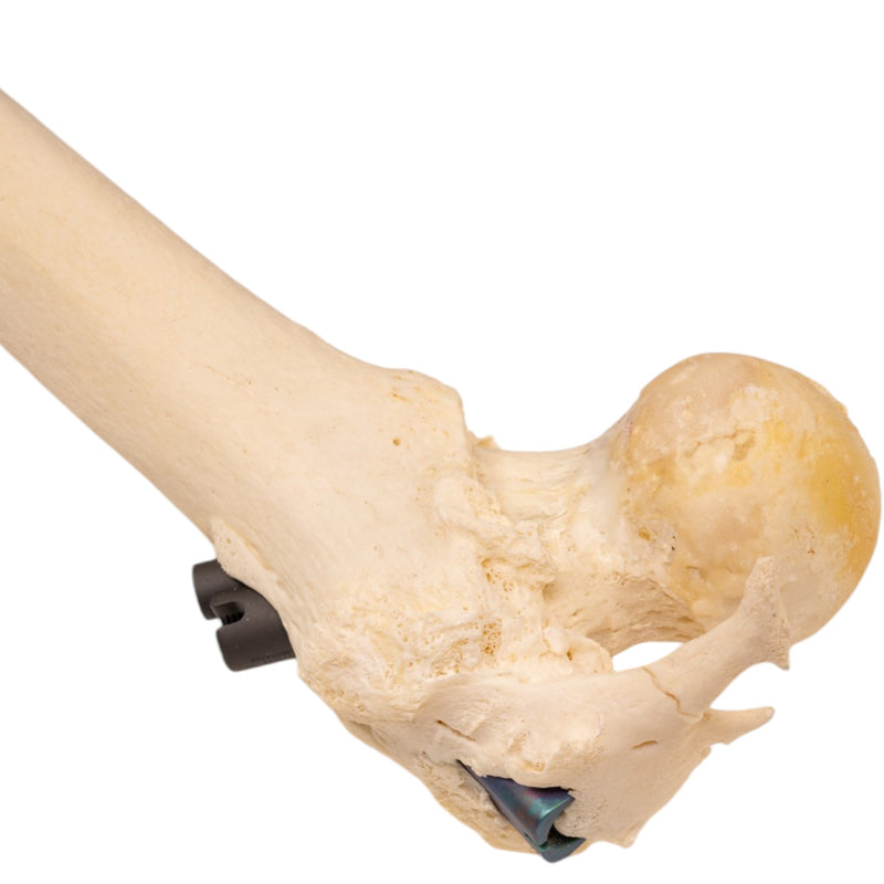 Real Human Left Leg - Pathology