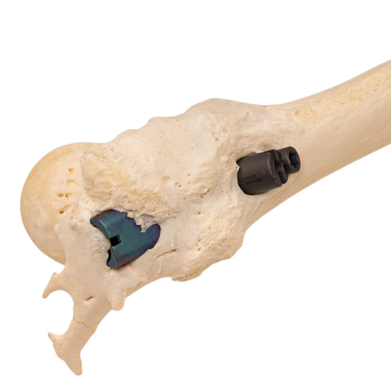 Real Human Left Leg - Pathology