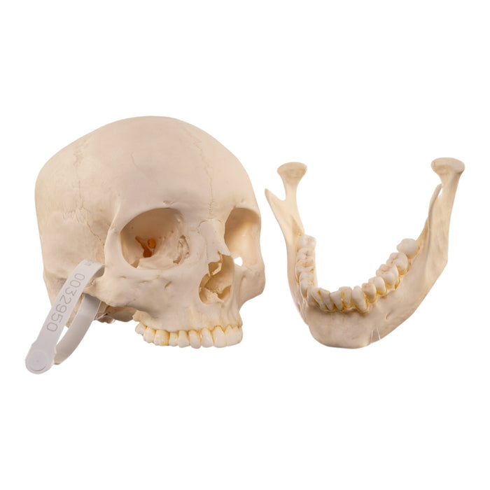 Real Human Skull